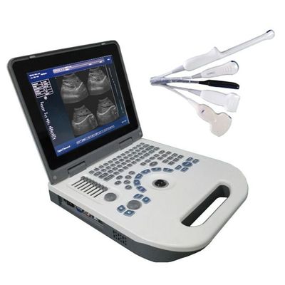 کیفیت  TGC Control Notebook Ultrasound Scanner For Pregnancy Home Use کارخانه