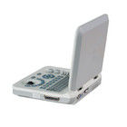 دستگاه سونوگرافی پرتابل رنگی LED 15 اینچی با زاویه اسکن 60 درجه و عمق نمایش ≥250 میلی‌متر