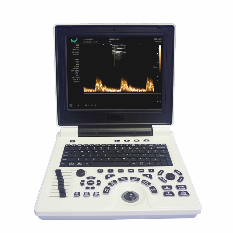 دستگاه سونوگرافی داپلر رنگی قابل حمل OB GYN در بارداری