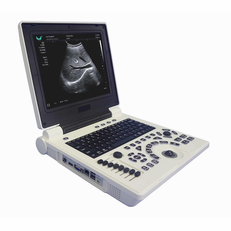 دستگاه سونوگرافی داپلر رنگی قابل حمل OB GYN در بارداری