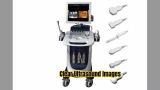 اسکنر اولتراسوند داپلر PW CFM حالت PDI