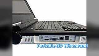 سونوگرافی قابل حمل E20 Clinical Hospital