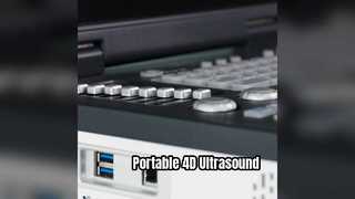 دستگاه سونوگرافی 4 بعدی داپلر قابل حمل ICU آماده