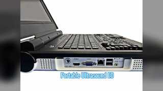 اسکن اورولوژی سونوگرافی داپلر رنگی قابل حمل E0